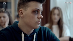 Zbliżenie na twarz nastolatka z podbitym okiem siedzącego w klasie.